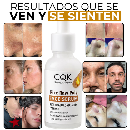 Serum Arroz + Acido Hialuronico