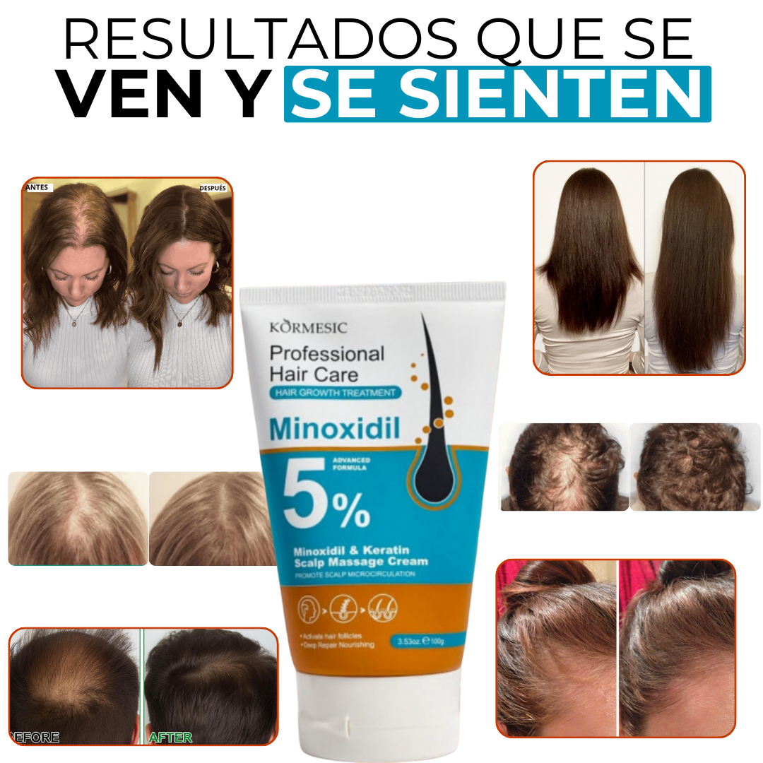 MINOXIDIL & KERATIN 5%