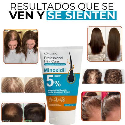 MINOXIDIL & KERATIN 5%