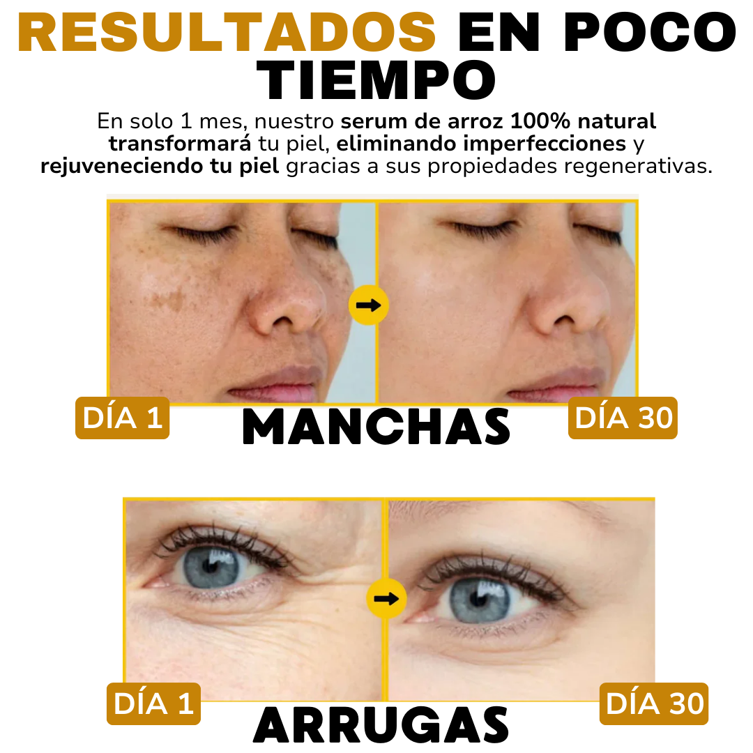 Serum Arroz + Acido Hialuronico