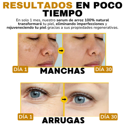 Serum Arroz + Acido Hialuronico